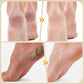 Manual Foot File for Dead Skin & Callus