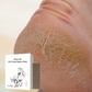 ⏳Limited-time 50% off⏰Horse Oil Dry Crack Repair Patch for Hands & Feet🩹