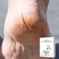 ⏳Limited-time 50% off⏰Horse Oil Dry Crack Repair Patch for Hands & Feet🩹